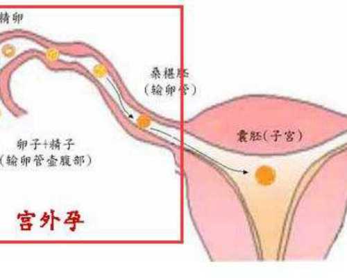 广州添丁国际助孕中心可信 广州三代试管哪个医院较好 ‘怀孕b超图形看男女’