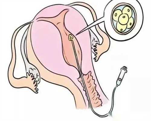 养囊8个胚胎只成功1个原因？8个胚胎养囊成功率*代生小孩费用
