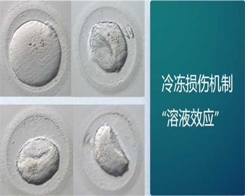 想怀双胞胎能同房吗？跟什么因素有关？