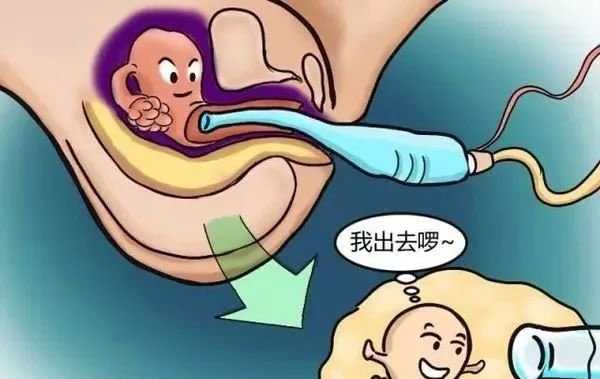 萍乡夫妻出38万代孕借腹生子_萍乡国内代孕_泰国试管婴儿流程是怎样的？需要
